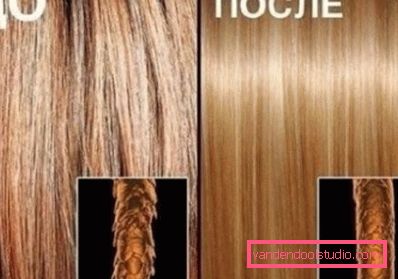 włosy przed i po zabiegu