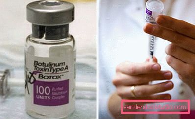 ampułka botox ampułka botox