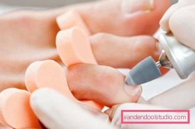 zabieg na stopy z maszyną do pedicure