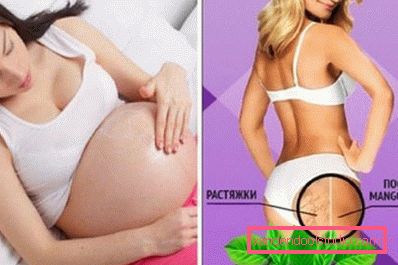 stosowanie kremu na rozstępy