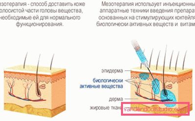 Mezoterapia włosów