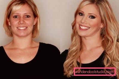 blondynka po zabiegu
